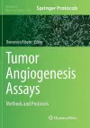 Tumor Angiogenesis Assays cover