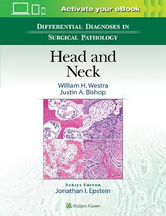 Differential Diagnoses in Surgical Pathology: Head and Neck cover