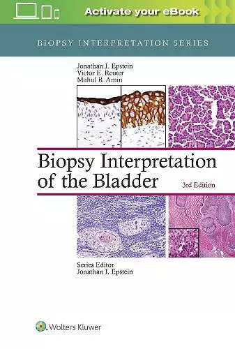 Biopsy Interpretation of the Bladder cover