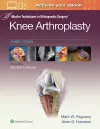 Master Techniques in Orthopedic Surgery: Knee Arthroplasty cover