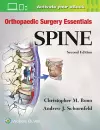 Orthopaedic Surgery Essentials: Spine cover