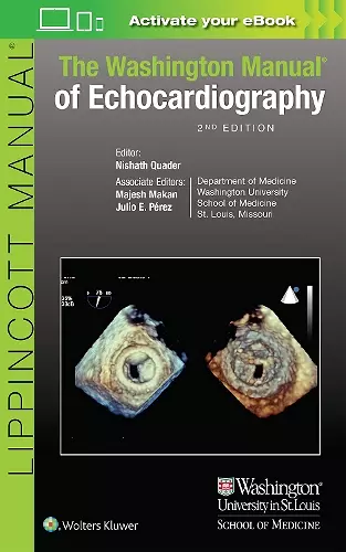 The Washington Manual of Echocardiography cover