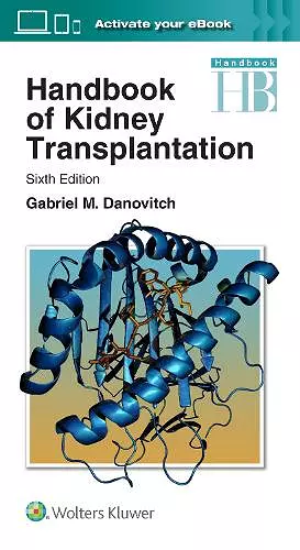 Handbook of Kidney Transplantation cover