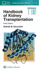 Handbook of Kidney Transplantation cover