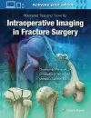Illustrated Tips and Tricks for Intraoperative Imaging in Fracture Surgery cover