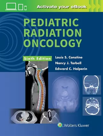 Pediatric Radiation Oncology cover