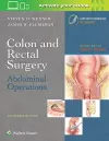 Colon and Rectal Surgery: Abdominal Operations cover