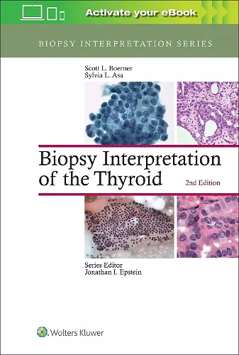 Biopsy Interpretation of the Thyroid cover