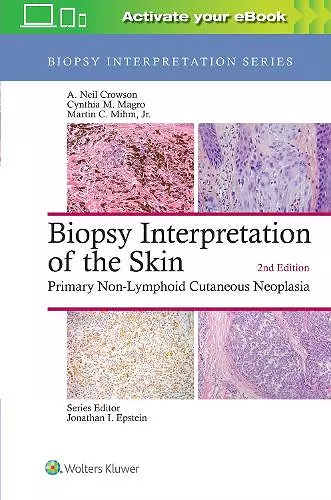 Biopsy Interpretation of the Skin cover