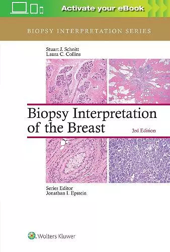 Biopsy Interpretation of the Breast cover