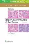 Biopsy Interpretation of the Breast cover