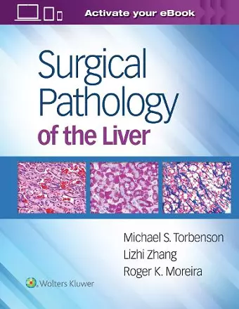 Surgical Pathology of the Liver cover