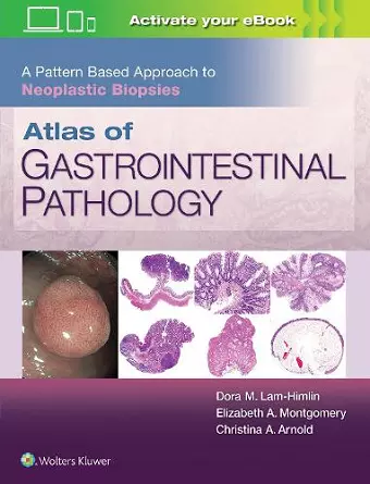 Atlas of Gastrointestinal Pathology: A Pattern Based Approach to Neoplastic Biopsies cover