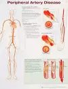 Peripheral Artery Disease cover