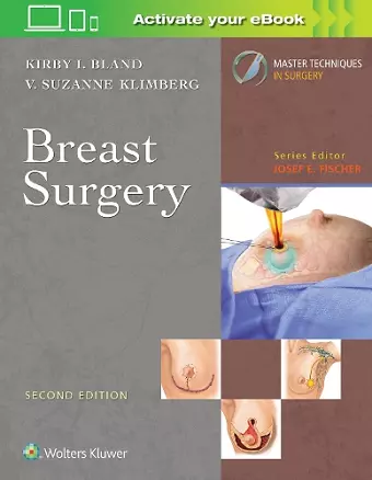 Master Techniques in Surgery: Breast Surgery cover