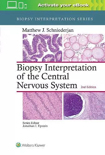 Biopsy Interpretation of the Central Nervous System cover