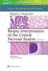 Biopsy Interpretation of the Central Nervous System cover