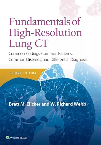 Fundamentals of High-Resolution Lung CT cover