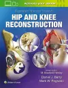 Illustrated Tips and Tricks in Hip and Knee Reconstructive and Replacement Surgery cover