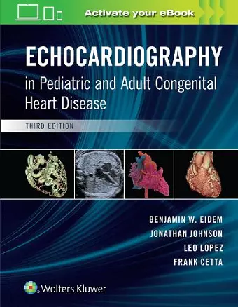 Echocardiography in Pediatric and Adult Congenital Heart Disease cover