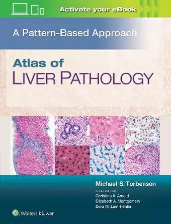 Atlas of Liver Pathology: A Pattern-Based Approach cover