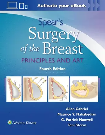 Spear's Surgery of the Breast cover