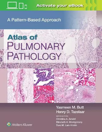 Atlas of Pulmonary Pathology cover