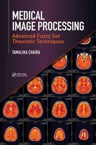 Medical Image Processing cover