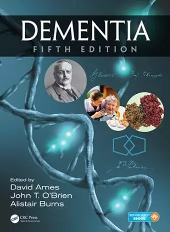 Dementia cover