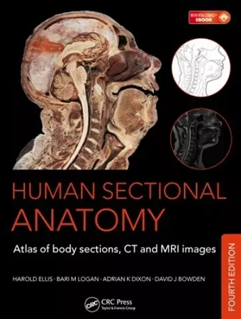 Human Sectional Anatomy cover