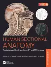 Human Sectional Anatomy cover