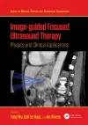 Image-guided Focused Ultrasound Therapy cover