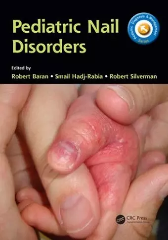 Pediatric Nail Disorders cover