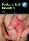 Pediatric Nail Disorders cover