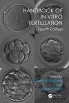 Handbook of In Vitro Fertilization cover