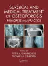 Surgical and Medical Treatment of Osteoporosis cover