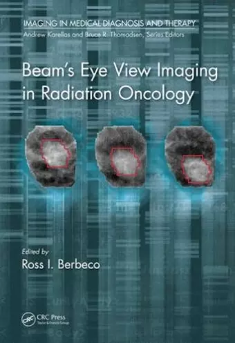 Beam's Eye View Imaging in Radiation Oncology cover