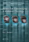 Beam's Eye View Imaging in Radiation Oncology cover