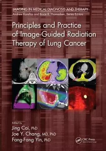 Principles and Practice of Image-Guided Radiation Therapy of Lung Cancer cover