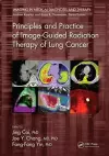 Principles and Practice of Image-Guided Radiation Therapy of Lung Cancer cover