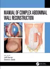 Manual of Complex Abdominal Wall Reconstruction cover