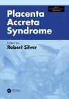 Placenta Accreta Syndrome cover