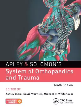 Apley & Solomon's System of Orthopaedics and Trauma cover