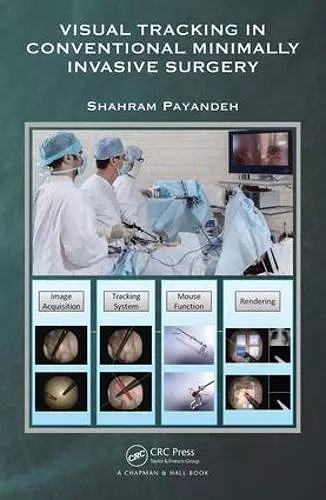 Visual Tracking in Conventional Minimally Invasive Surgery cover