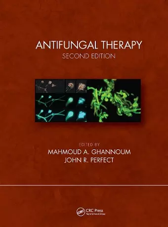 Antifungal Therapy, Second Edition cover