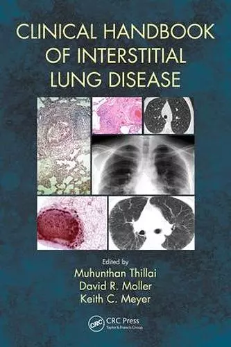 Clinical Handbook of Interstitial Lung Disease cover