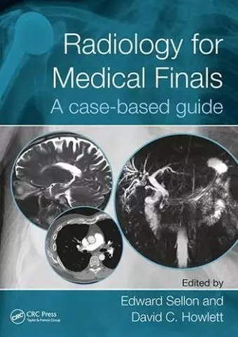 Radiology for Medical Finals cover