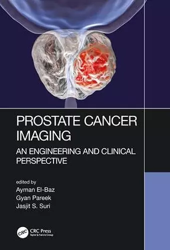 Prostate Cancer Imaging cover