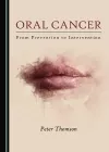Oral Cancer cover