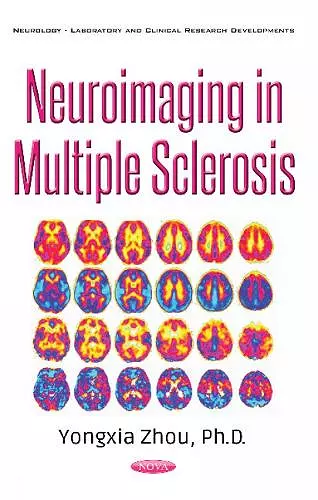 Neuroimaging in Multiple Sclerosis cover